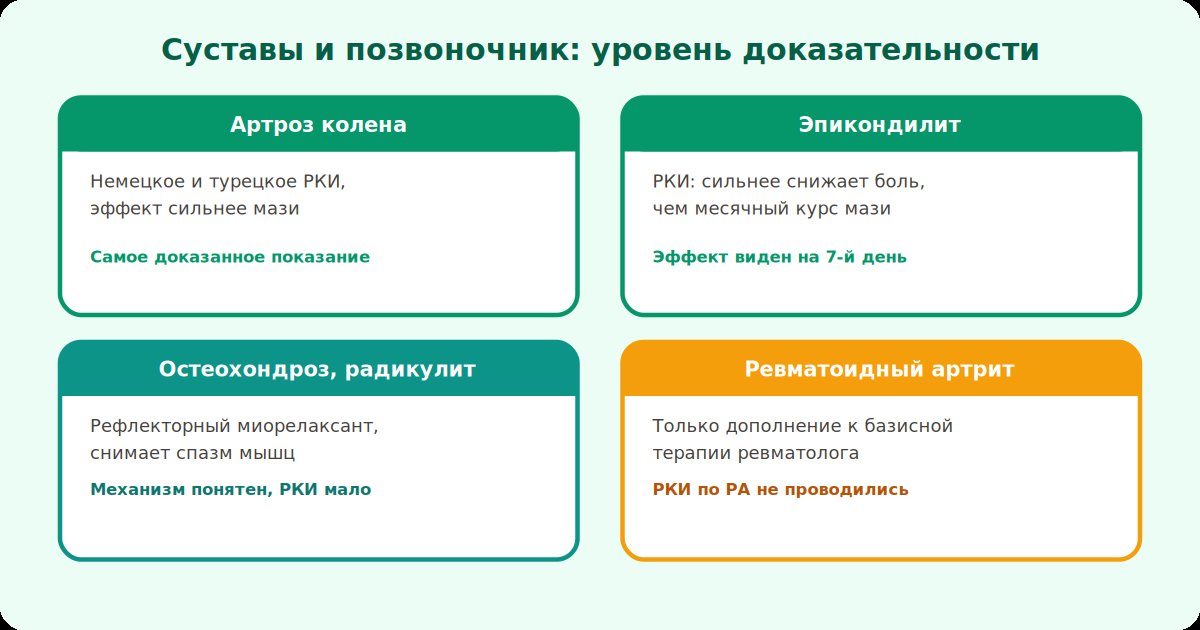 Зоны постановки при боли в суставах и позвоночнике: колено, локоть, поясница